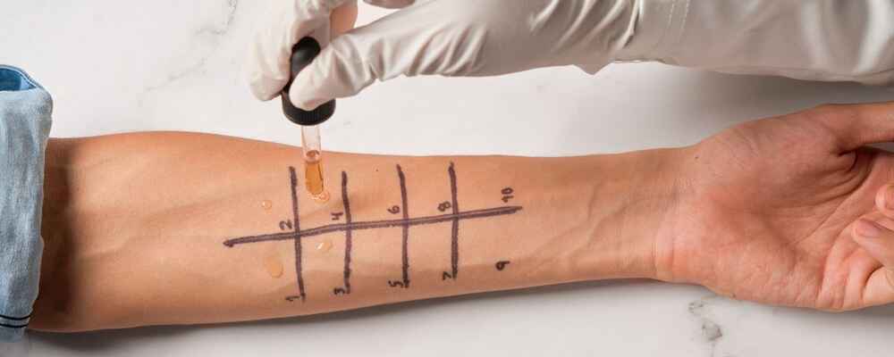 Doctor conducting allergy testing with patient to see allergic reactions