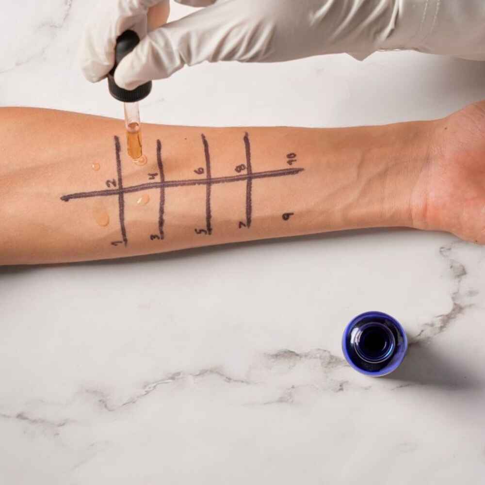 Doctor conducting allergy testing with patient to see allergic reactions