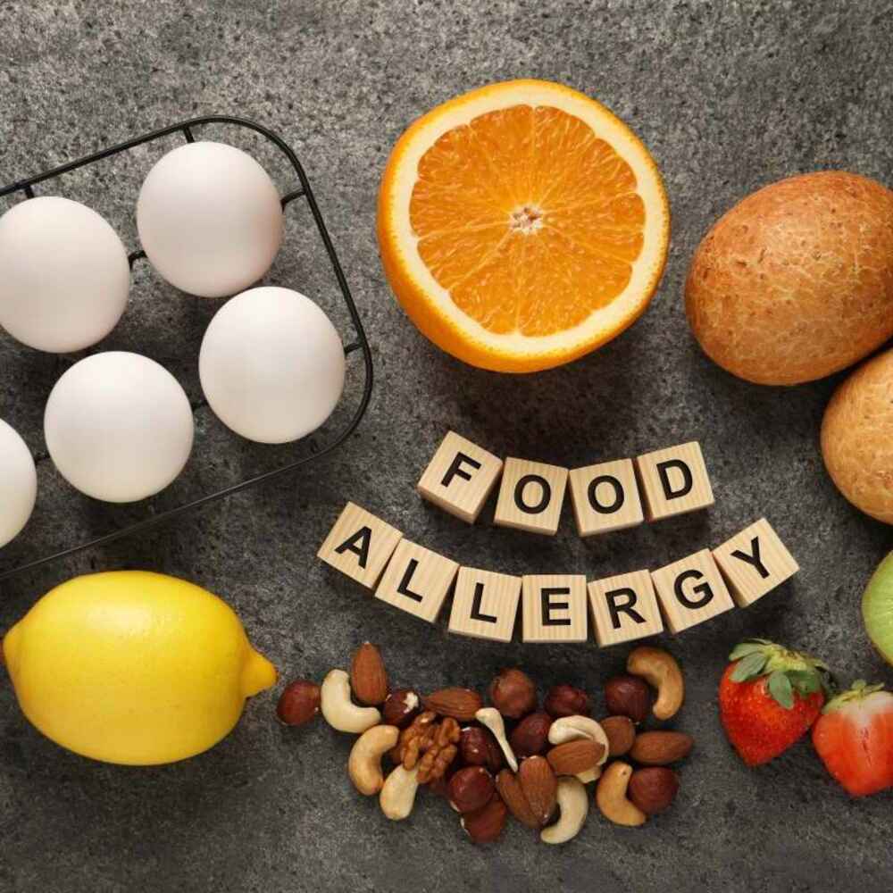 Food allergies